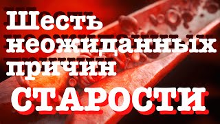 Шесть неожиданных причин старости