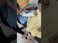 فك الجبس الطفله     