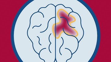 Detecting “Invisible” Brain Tumors with Precision Diagnostics | Penn Precision Medicine