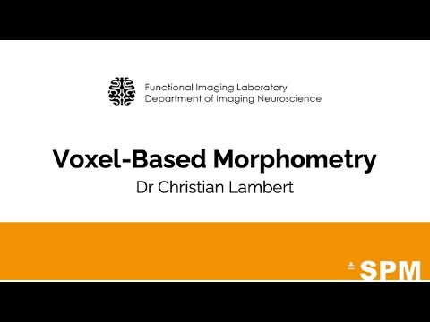 Voxel Based Morphometry: Analyzing Structural Brain Changes [Guide ...