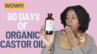 I Used CASTOR OIL for 60 days and THIS Happened!!