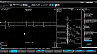 Sierra 4.1 EMG+ Tutorial