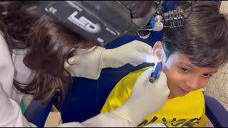 Baby Ear Piercing in Delhi | Safe Gunshot Ear Piercing by Dr. Purodha Prasad 👶👂✨