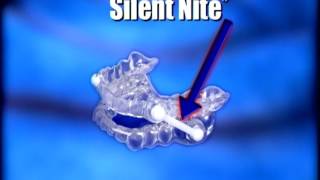 Silent Nite Snore Guard