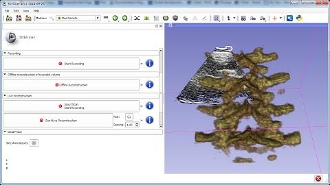 Live ultrasound volume reconstruction in 3D Slicer