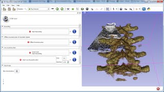 Live ultrasound volume reconstruction in 3D Slicer