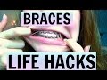 BRACES LIFE HACKS + TIPS!