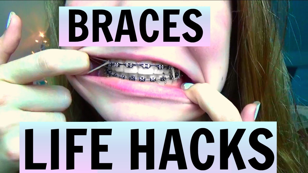 BRACES LIFE HACKS + TIPS! - YouTube