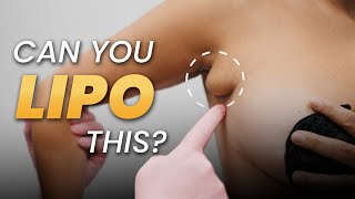 Can You Liposuction Underarm Fat? The Answer Might Surprise You