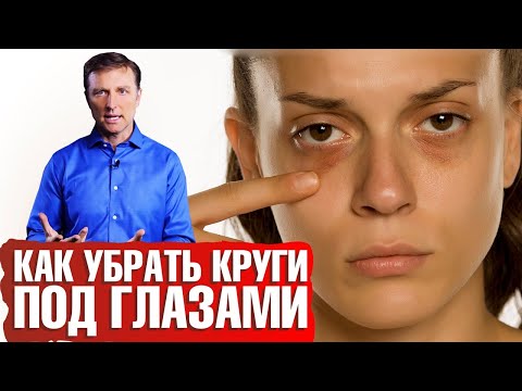 Темные круги под глазами: как избавиться? Почему появляются синяки под глазами? 📣