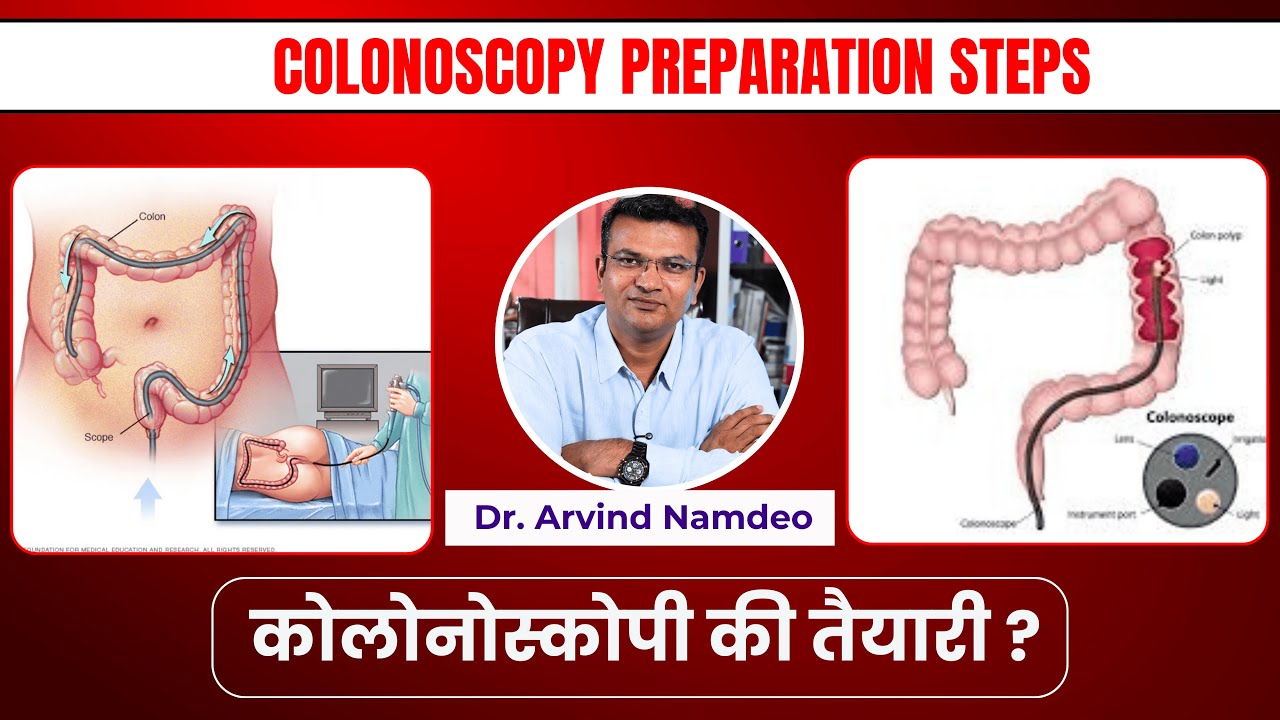 Colonoscopy से पहले सही तैयारी क्यों जरूरी है और जांच से पहले क्या क्या करना चाहिए ?