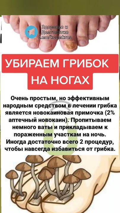 убираем грибок на ногах #народнаямедицина #народныерецепты # ...