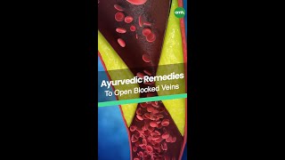 नसों की ब्लॉकेज खोलने के आयुर्वेदिक उपाय I The Ayurvedic Remedies for Opening Blocked Veins screenshot 3