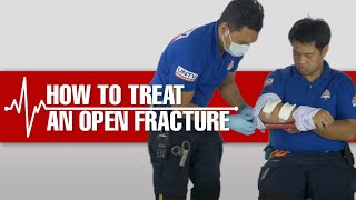 How to Treat an Open Fracture? #Lifesaver #FirstAid101
