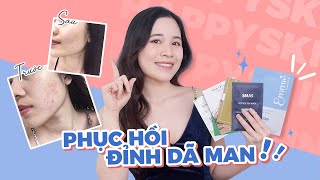 Review so sánh 6 MẶT NẠ GIẤY LÀM DỊU, PHỤC HỒI DA từ RẺ đến MẮC  Smas, Caryophy, Skin1004