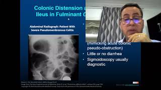 Clostridioides Difficile Colitis IDSA and More
