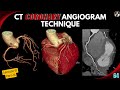 CT CORONARY ANGIOGRAM TECHNIQUE - Part-01 | Blood Supply | Indication | ECG gating | Preparation |