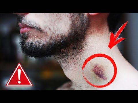 ЗАСОС ТАИТ В СЕБЕ ОПАСНОСТЬ О КОТОРЫЙ ВЫ И НЕ ПОДОЗРЕВАЛИ!
