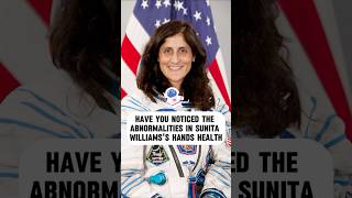 Have You Noticed Any Hand Anomalies With Sunita Williams?