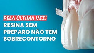 Pela Última Vez Resina Sem Preparo Não Tem Sobrecontorno - Mylene E Renato