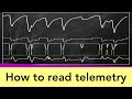 F1 Telemetry - How the car performance translates to those wiggly lines