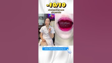 niềng răng ăn gì p8 #thinhhanh #dentist #nhakhoaquocteachau #niengrang