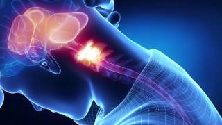 Chiropractic Care & Headaches