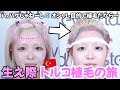 【女性 おでこ植毛】 トルコ植毛したい女性に教えたい事があります【ハウスダスト|整形|自毛植毛|薄毛の窓口】