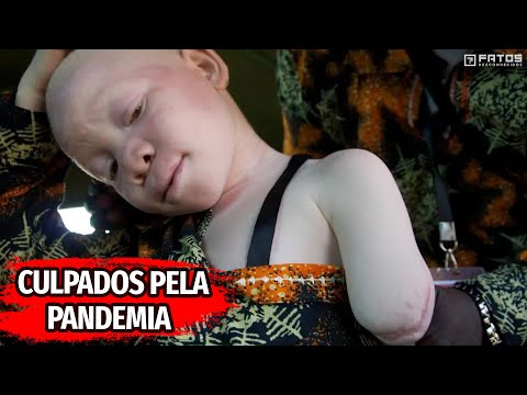 Vídeo: Caça Ao Albino Africano