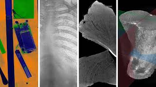 KA Imaging: 10 Years of Innovation
