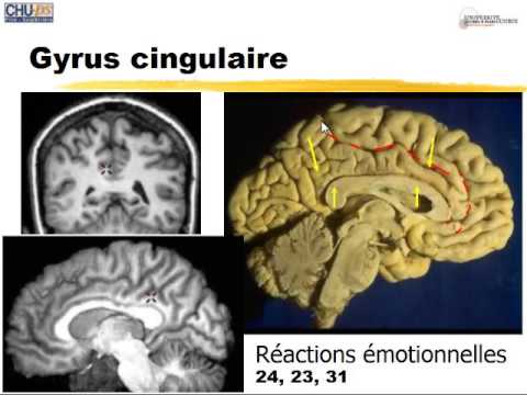 Dr Hasboun: Système limbique