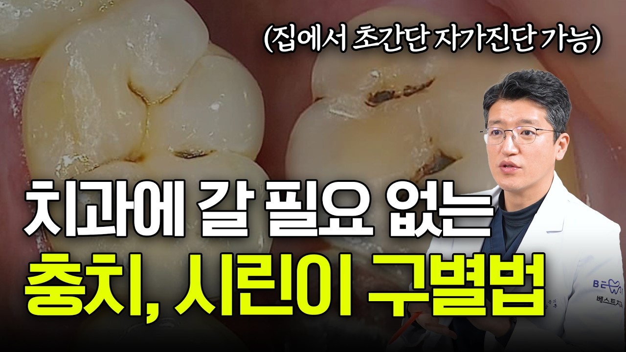 충치·시린이 단계별 기준 