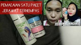 Cream farma Acne | Cream jerawat the best | Belum abis satu paket udah kinclong