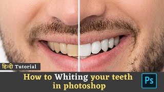 teeth सफेद कैसे करें | How to Whiten Teeth in Photoshop #shorts #ytshorts #yt screenshot 3