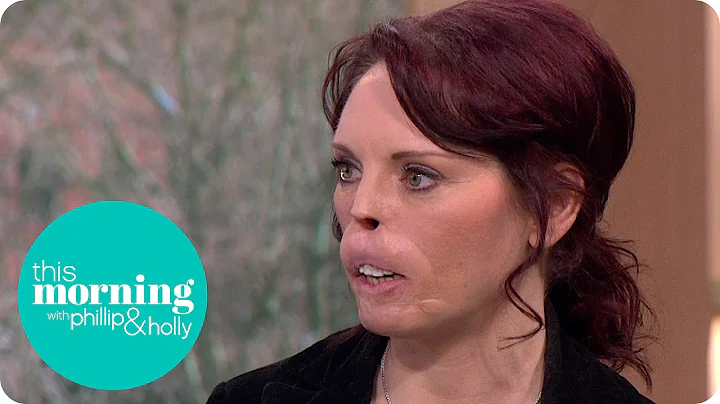 The Undateables' James And Tammy On Looking For Lo...