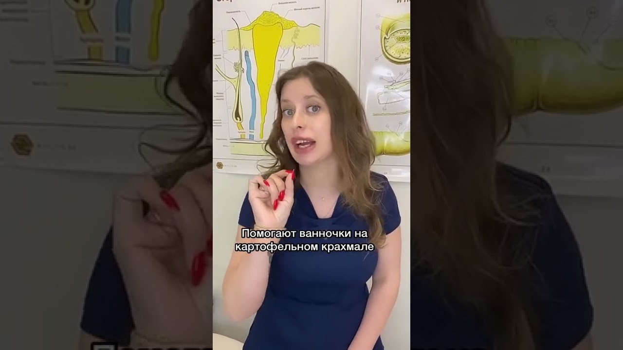 Как избавиться от экземы в дом условиях?