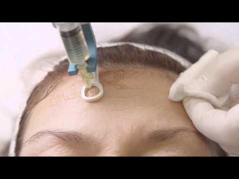 Video: Trichologie - Příčiny Onemocnění Vlasů, Jejich Diagnostika A Léčba