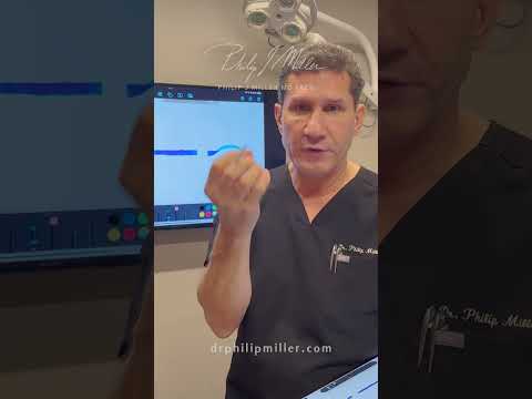 Video thumbnail: Why can’t you just shave down my bump as much as you can with MicroRhinoplasty?! · Dr. Philip Miller, MD, FACS