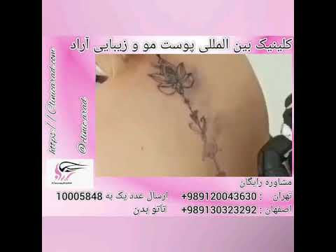 مراحل انجام تاتو بدن