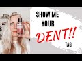 SHOW ME YOUR DENT (Perfume Tag) | TheTopNote #perfumecollection