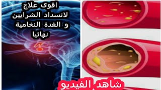 اقوى علاج ل انسداد الشرايين و علاج الغدة النخامية نهائيا