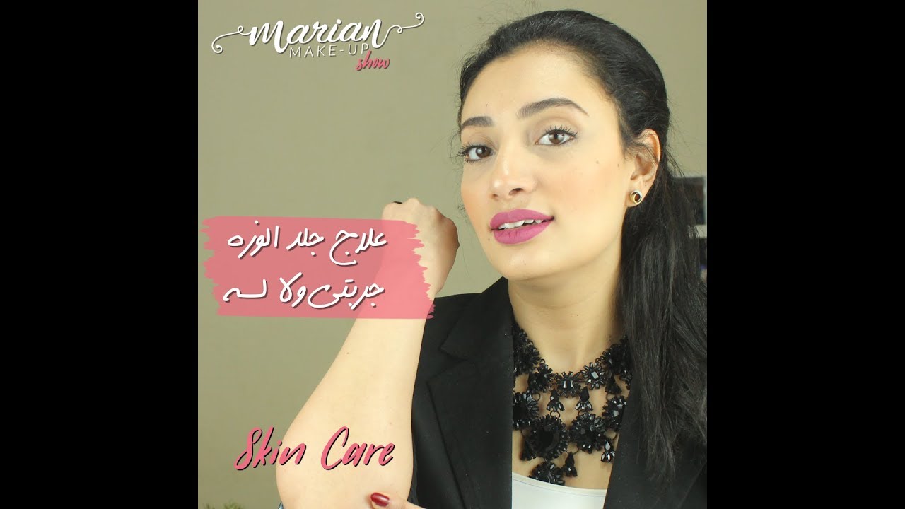 أسباب وعلاج جلد الوزة | Marian Samir