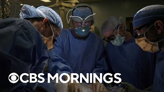 Scientists tout successful trial of pig-to-human kidney transplant