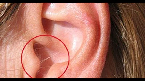 EAR HAIR IS THE FIRST WARNING SIGN OF THE MOST DANGEROUS DISEASE IN THE 21ST CENTURY