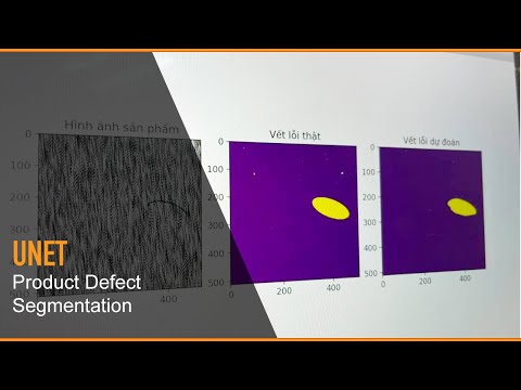 Sử dụng Unet để phân vùng, phát hiện sản phẩm lỗi - Mì AI
