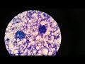 Cytology. Цитология маммологических мазков