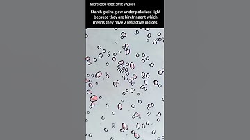 Potato starch under polarized light.