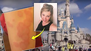 Family Was Being ‘Eaten Alive’ At Walt Disney World, Bitten 331 Times