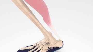 Orthotics Video