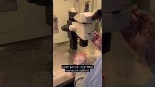 Inside The Ivf Lab - Ovum Pick Up Procedure For Ivf पक अप परकरय - आईवएफ लब क अदर